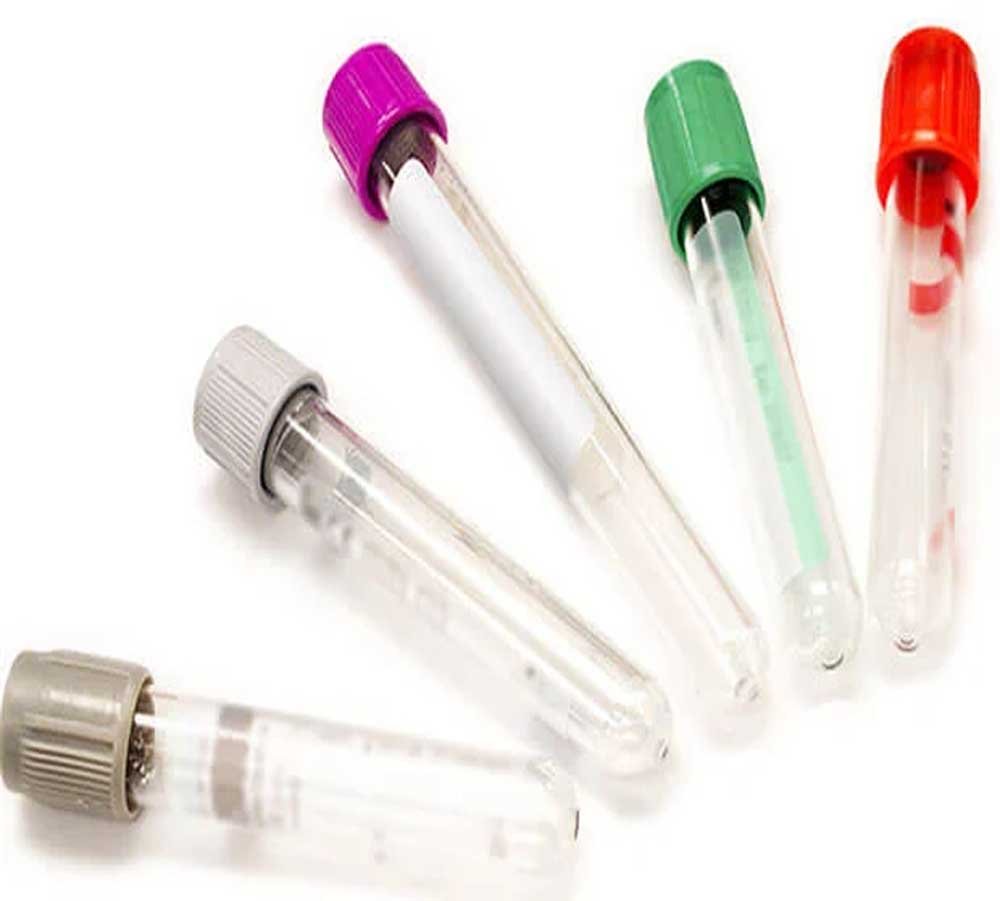 free-photo-test-tubes-medication-university-test-tube-free